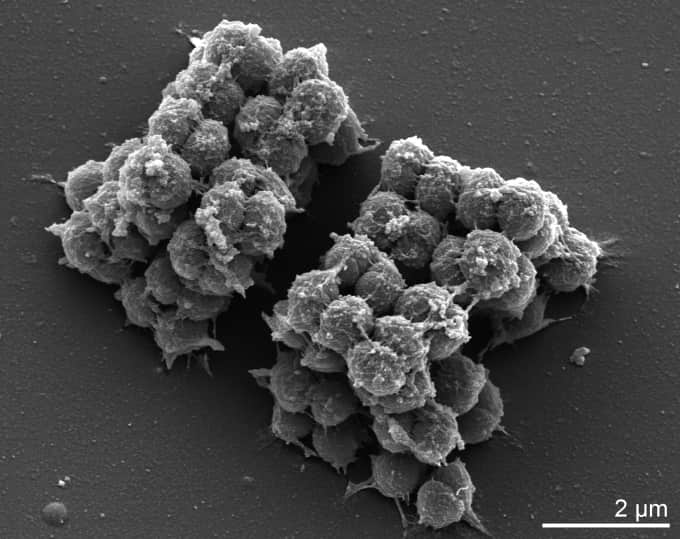 ¿Por qué huelen los pies? Scanning electron micrograph of Kytococcus sedentarius strain 541T Manfred Rohde